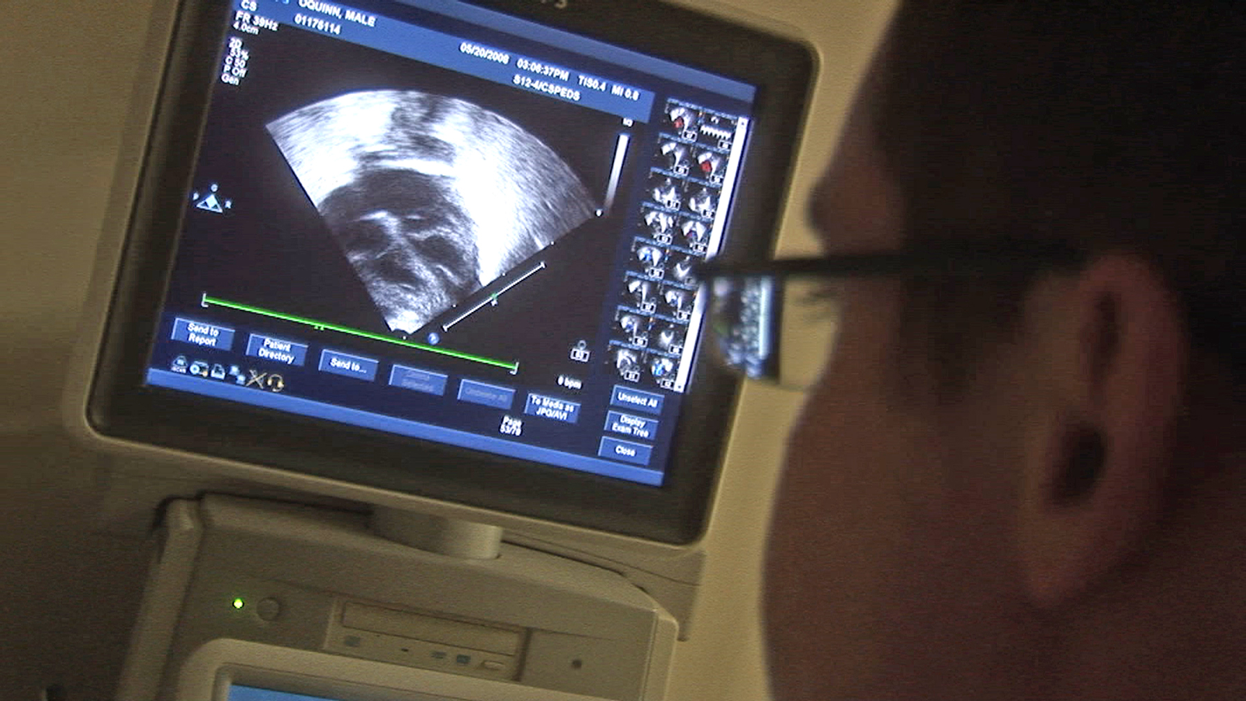 Program Cardiovascular Technology NonInvasive Option Northeast